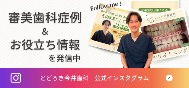 インスタグラム